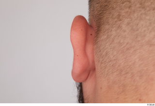 Ronaldo Biggato ear 0003.jpg